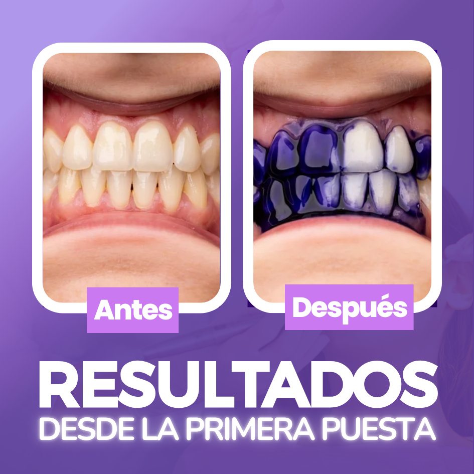 Yasenshi - Blanqueador Dental (🚨2x1 🚨)