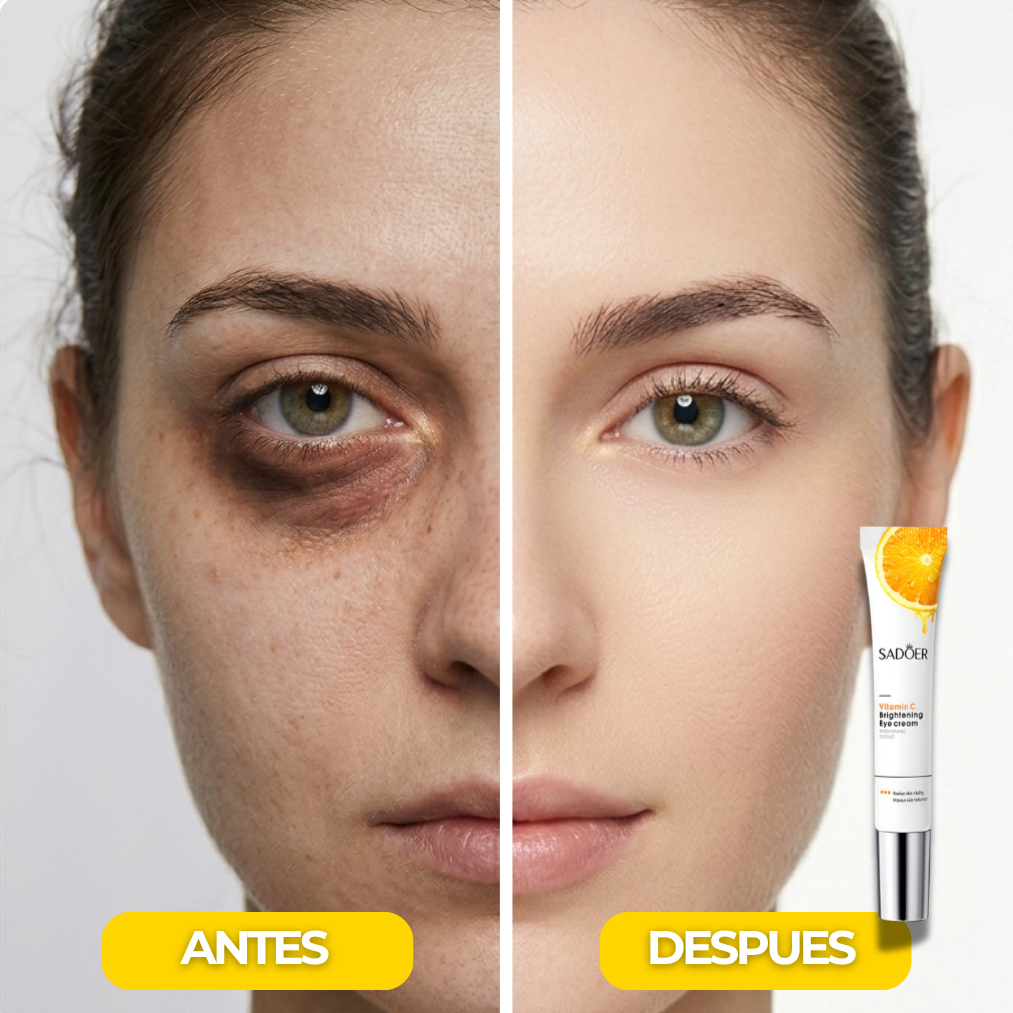 SADOER - Contorno Anti-ojeras + Vitamina C (🚨2x1 SOLO HOY🚨)